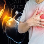 “La fibrilación auricular es la arritmia más frecuente en la población general. Es una alteración del ritmo cardíaco normal, que deja de ser rítmico para ser irregular”